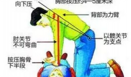 心肺复苏视频教学视频,视频教学核心步骤解析